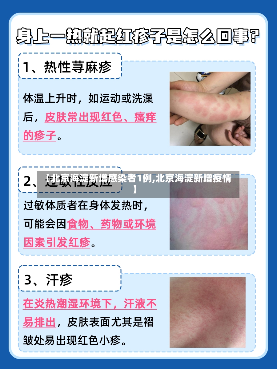 【北京海淀新增感染者1例,北京海淀新增疫情】-第2张图片