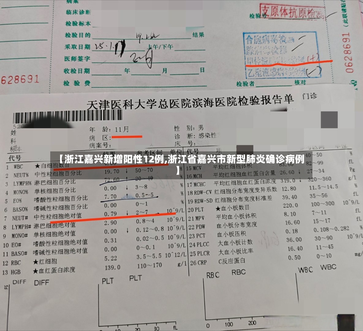 【浙江嘉兴新增阳性12例,浙江省嘉兴市新型肺炎确诊病例】