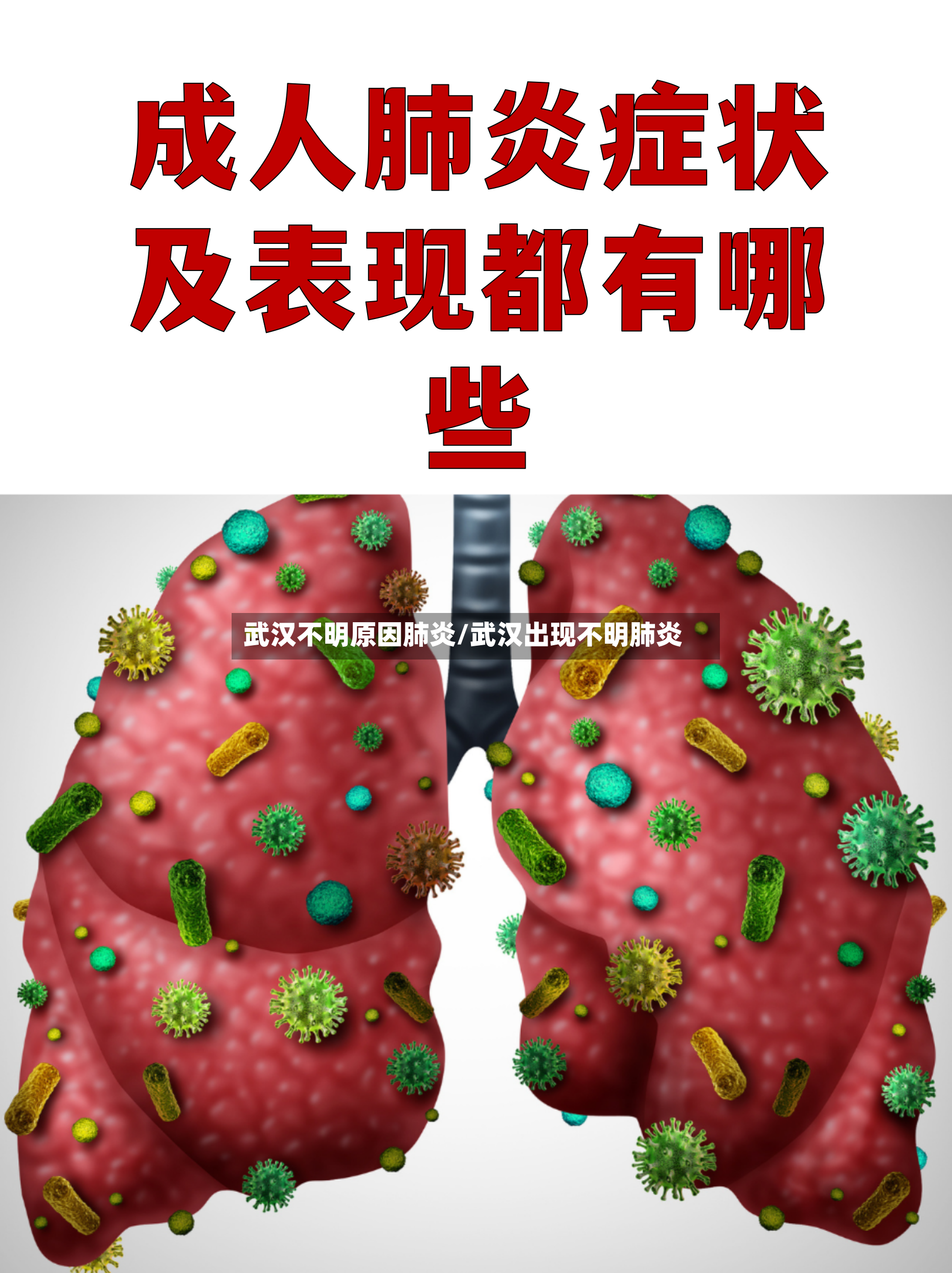 武汉不明原因肺炎/武汉出现不明肺炎