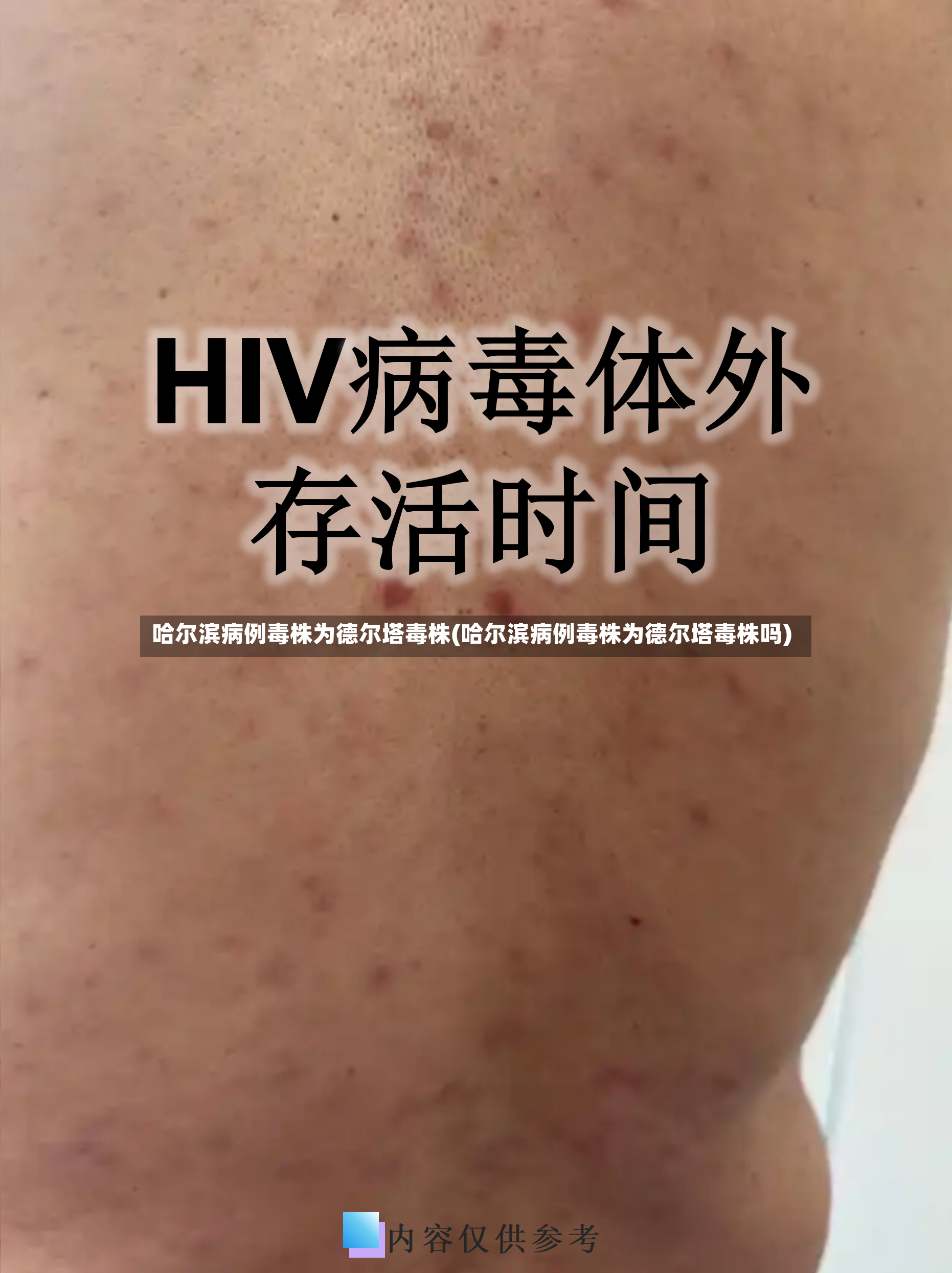 哈尔滨病例毒株为德尔塔毒株(哈尔滨病例毒株为德尔塔毒株吗)