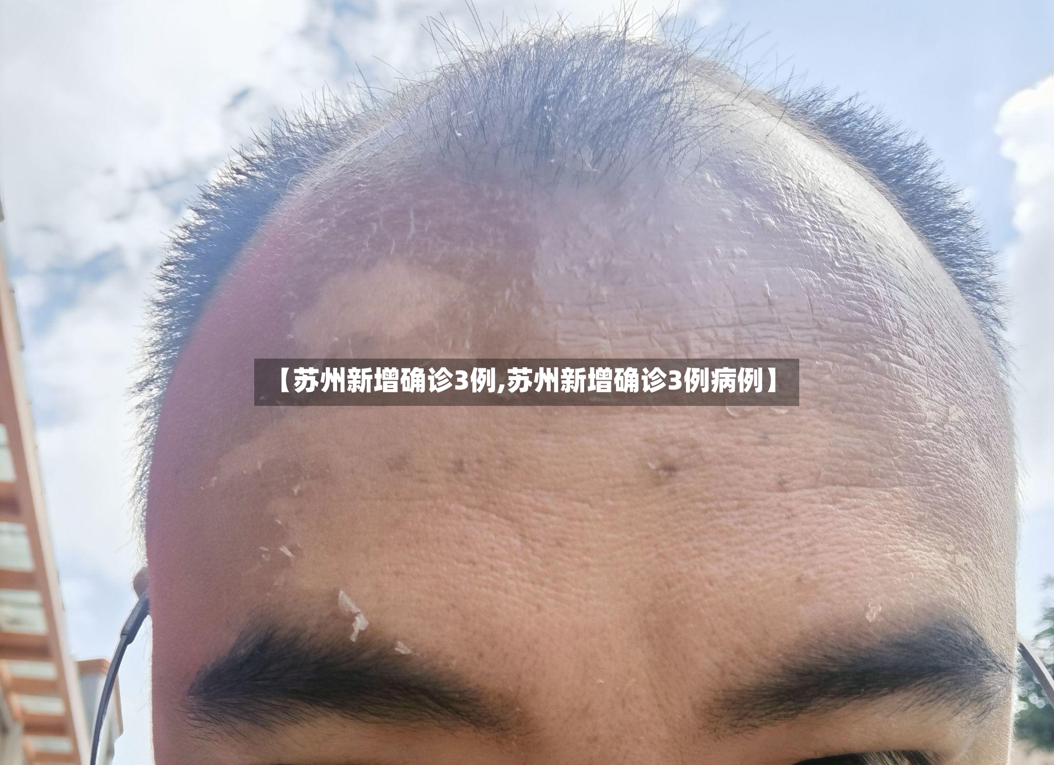 【苏州新增确诊3例,苏州新增确诊3例病例】-第3张图片