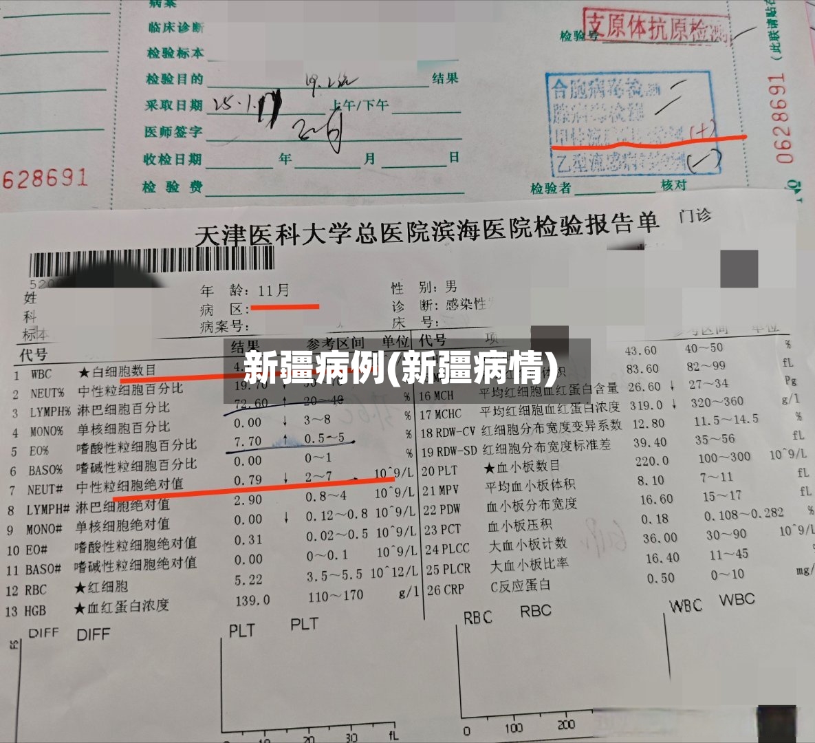 新疆病例(新疆病情)