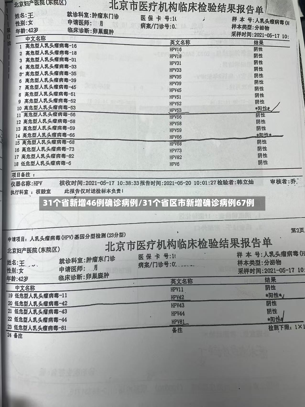 31个省新增46例确诊病例/31个省区市新增确诊病例67例-第2张图片