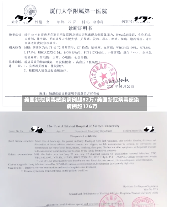 美国新冠病毒感染病例超82万/美国新冠病毒感染病例超176万