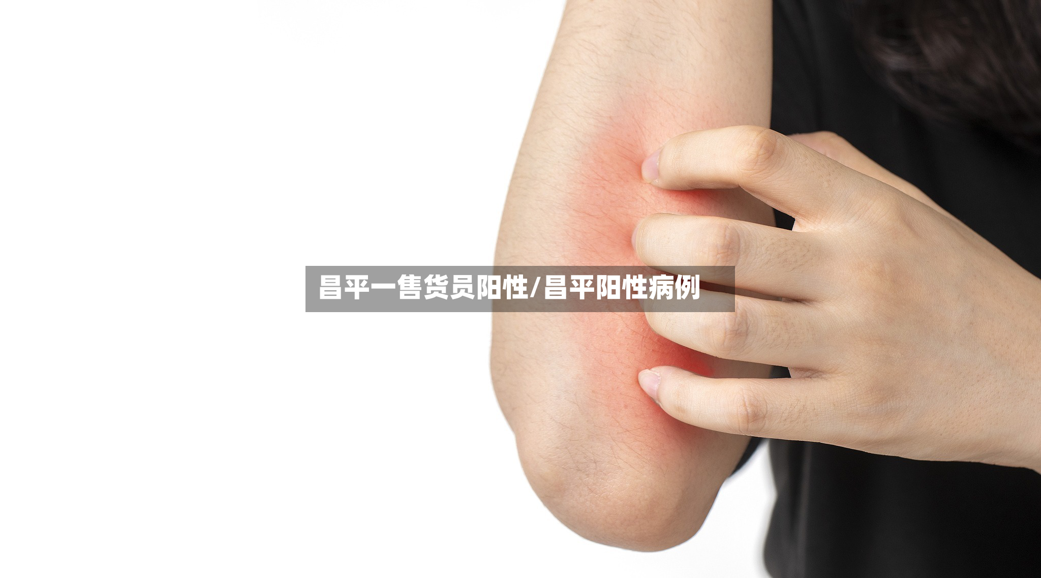 昌平一售货员阳性/昌平阳性病例-第2张图片