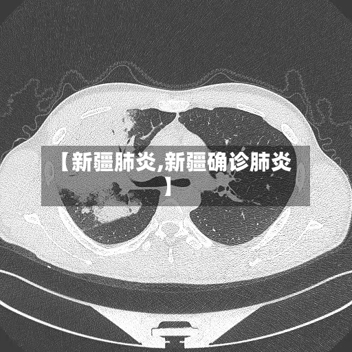 【新疆肺炎,新疆确诊肺炎】