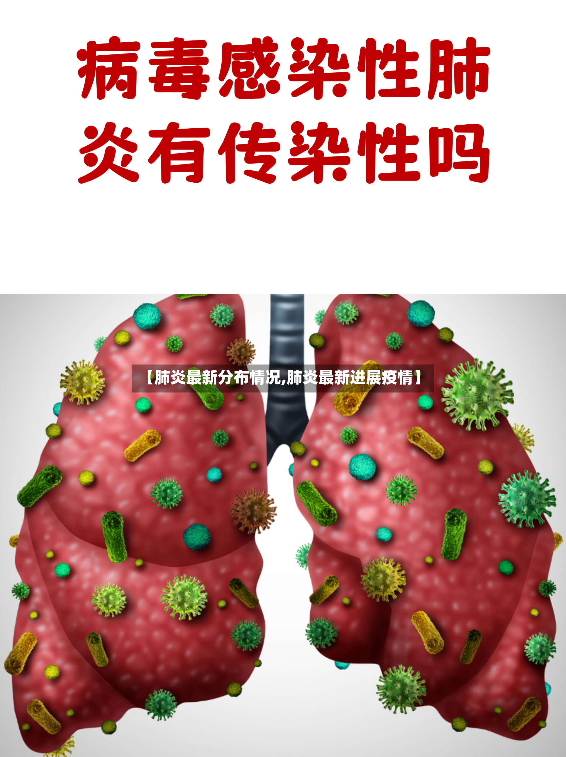 【肺炎最新分布情况,肺炎最新进展疫情】