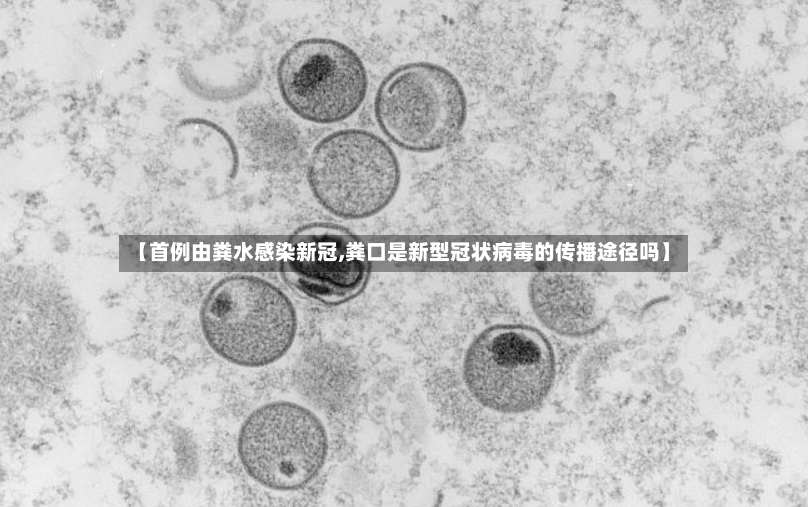 【首例由粪水感染新冠,粪口是新型冠状病毒的传播途径吗】