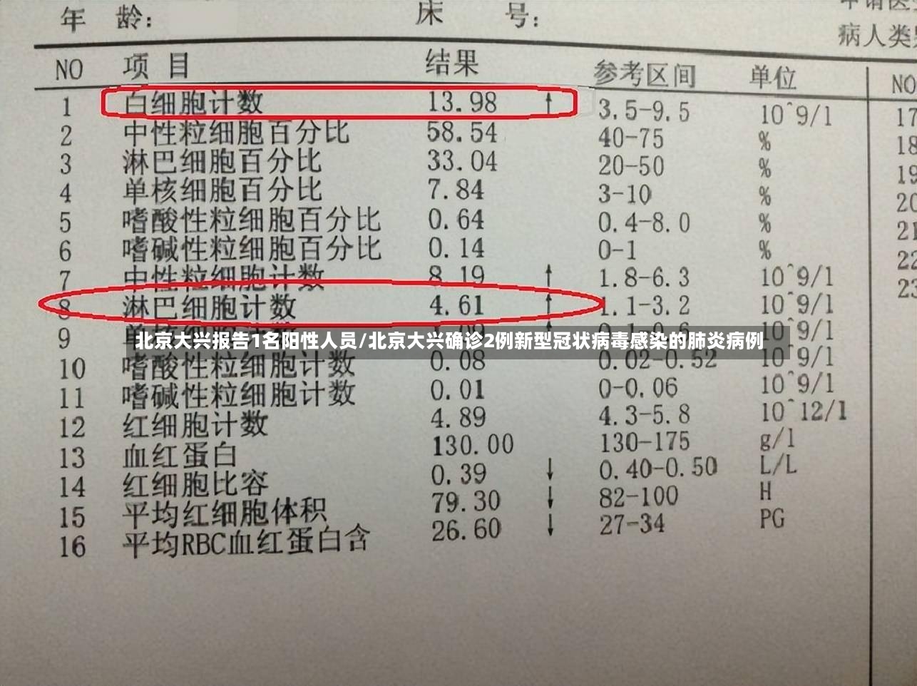 北京大兴报告1名阳性人员/北京大兴确诊2例新型冠状病毒感染的肺炎病例